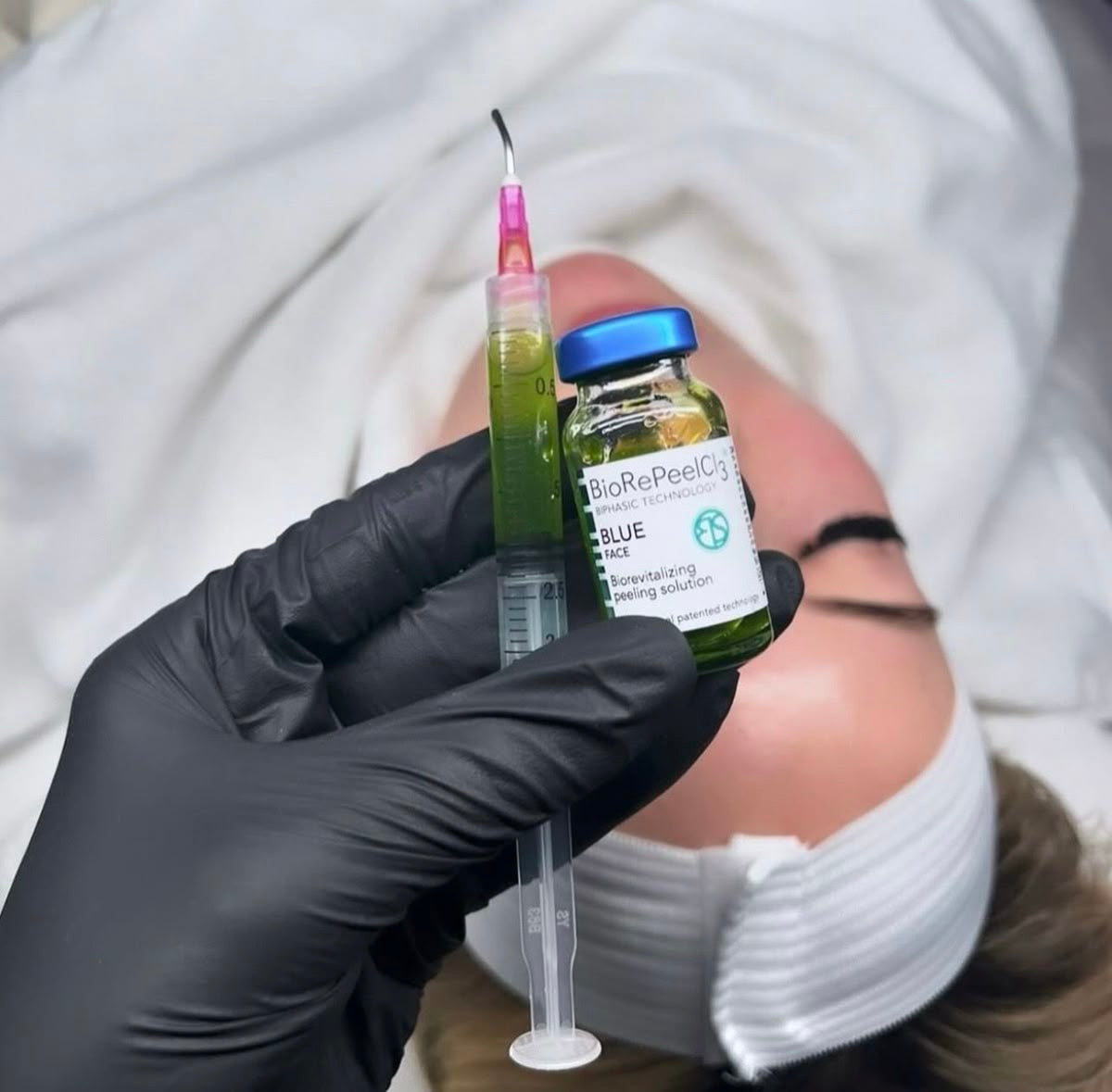 BioRePeel er en fleksibel behandling som er tilpasset alle aldre og hudtyper. hos Studio L
