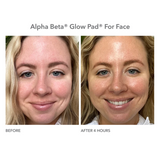 Glow Pad Intense Glow