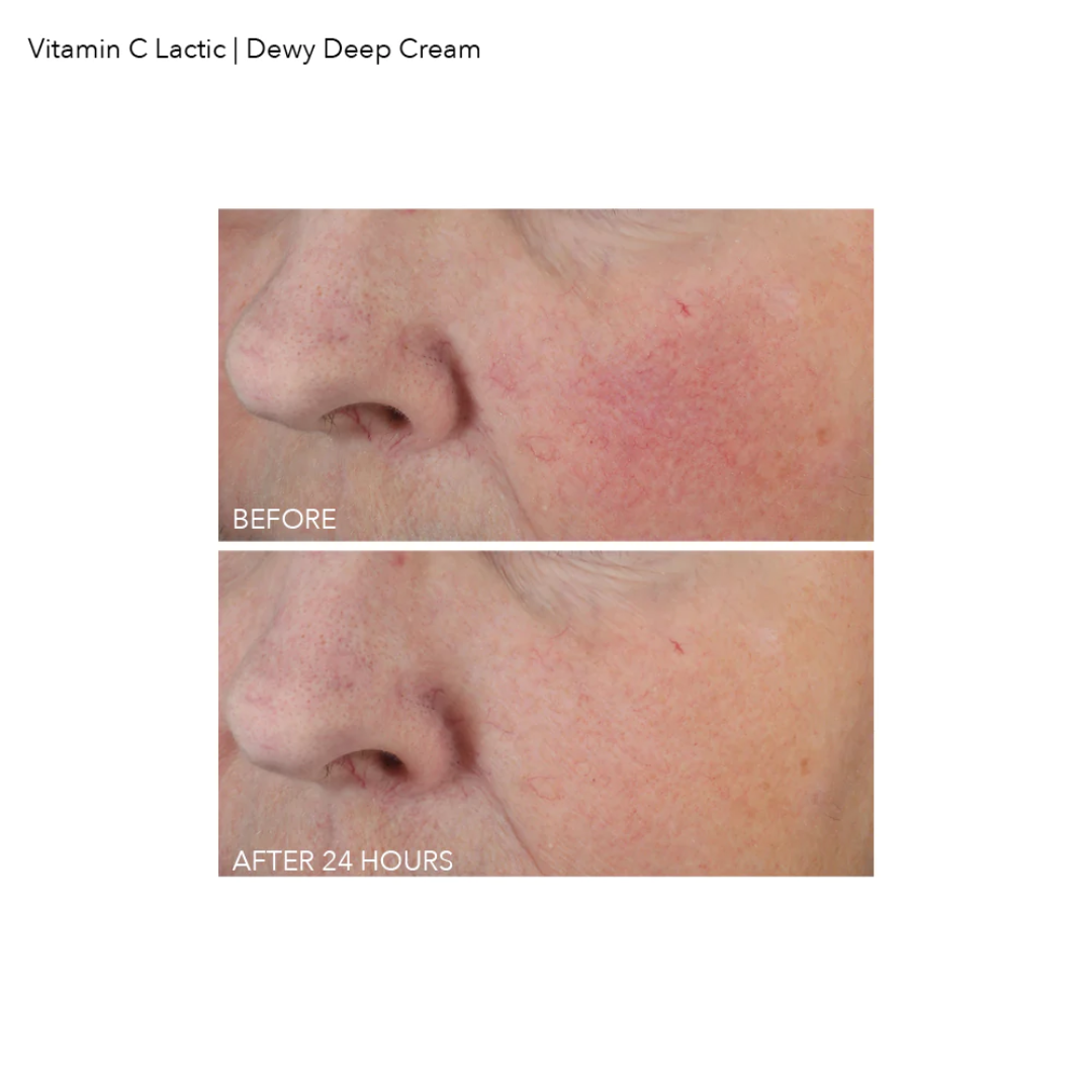 Vitamin C Dewy Deep Cream