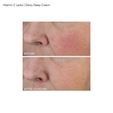 Vitamin C Dewy Deep Cream