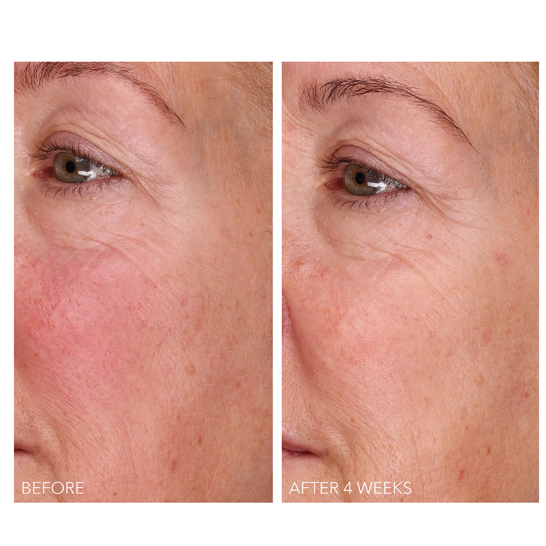 DermInfusions Fill + Repair Serum