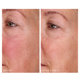 DermInfusions Fill + Repair Serum