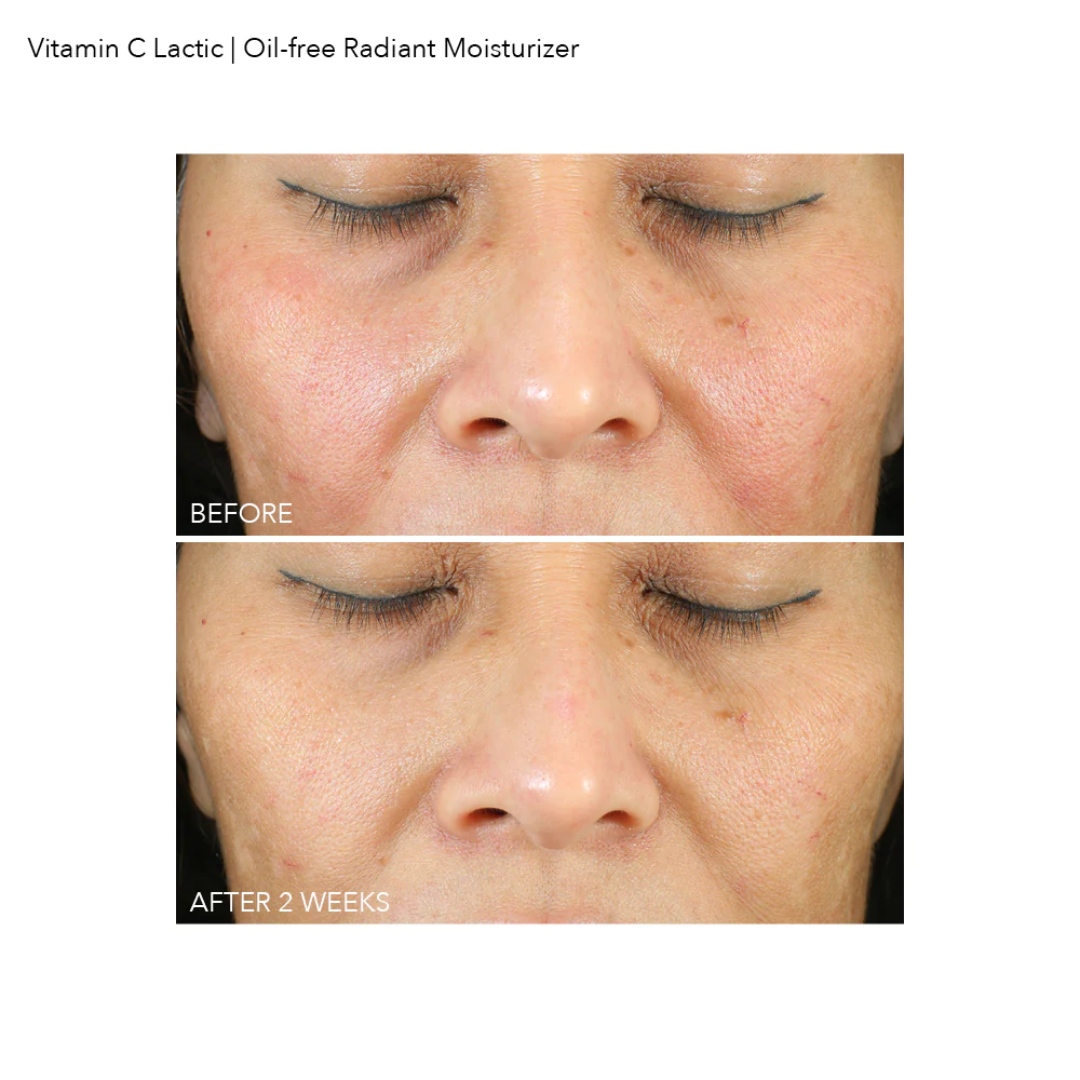 Vitamin C Lactic Oil-Free Radiant Moisturizer