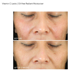 Vitamin C Lactic Oil-Free Radiant Moisturizer