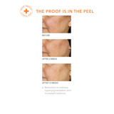 Alpha Beta Daily Peel Universal 5pk