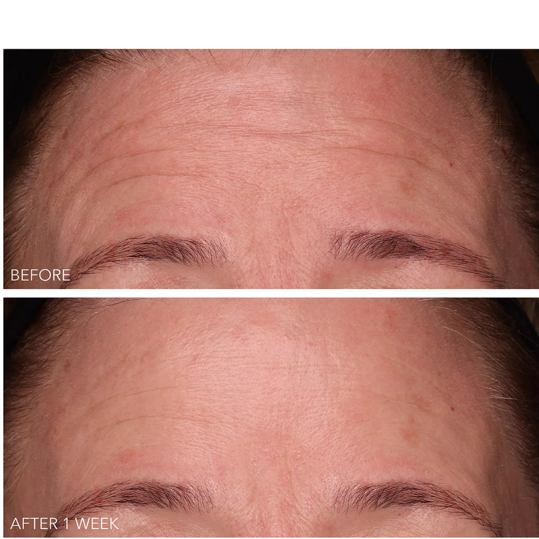 DermInfusions Fill + Repair Serum