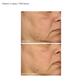 15% Vitamin C Firm & Bright Serum