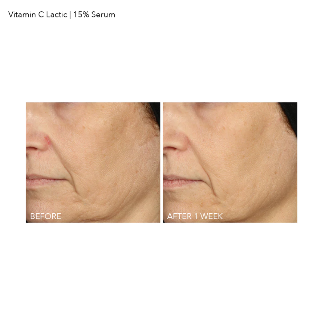 15% Vitamin C Firm & Bright Serum