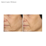 15% Vitamin C Firm & Bright Serum