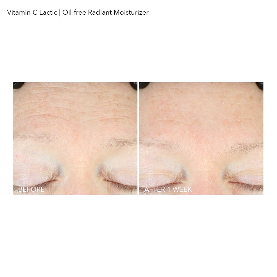 Vitamin C Lactic Oil-Free Radiant Moisturizer