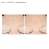 Vitamin C Lactic Oil-Free Radiant Moisturizer