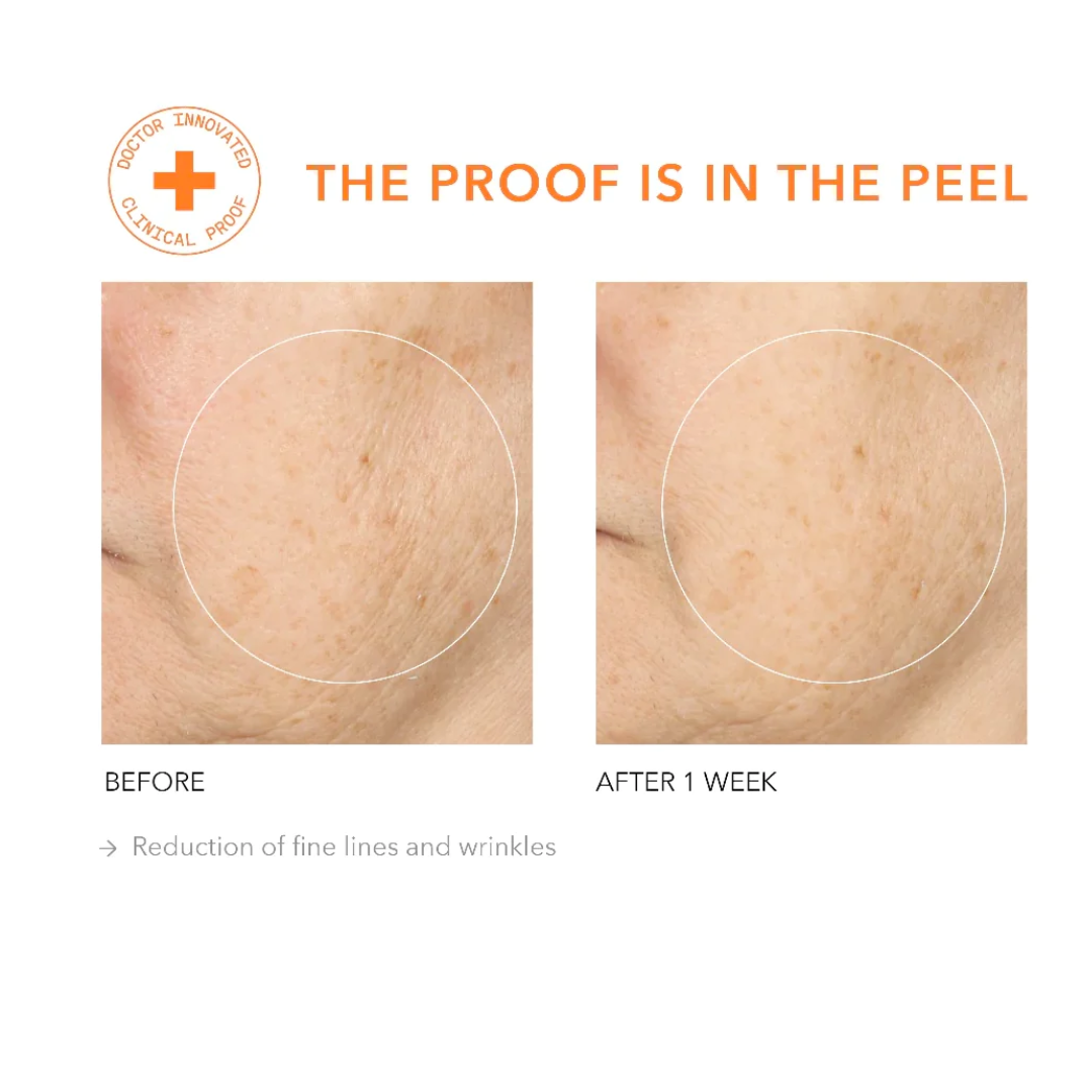 Alpha Beta Daily Peel Universal