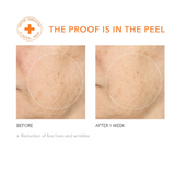 Alpha Beta Daily Peel Universal