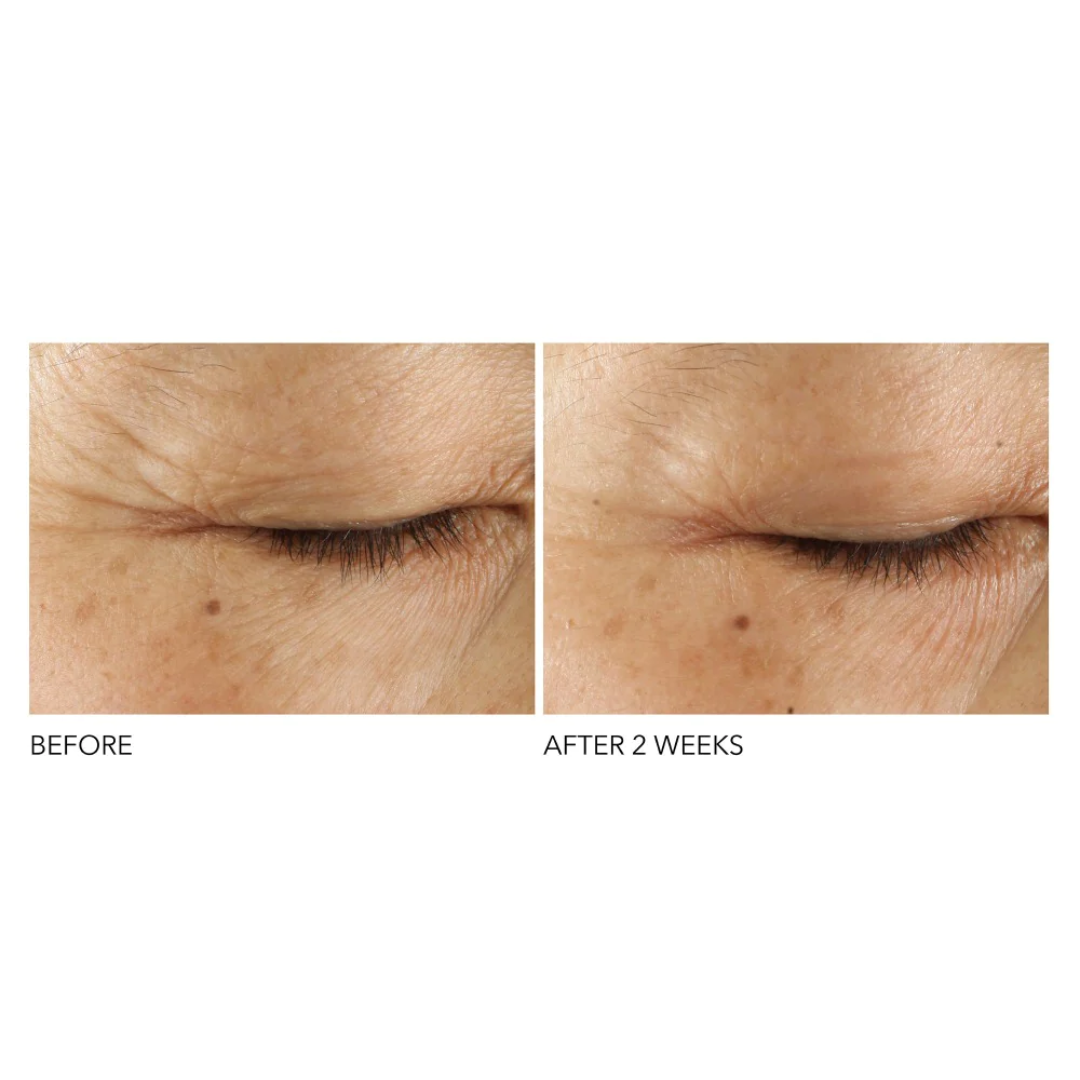 Advanced Retinol + Ferulic Triple Correction Eye Serum