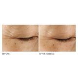 Advanced Retinol + Ferulic Triple Correction Eye Serum