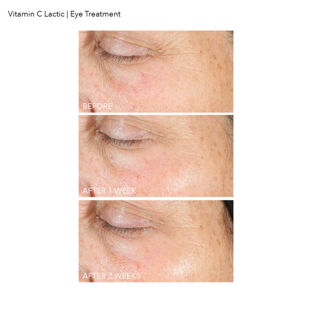 Firm & Bright Eye Treatment