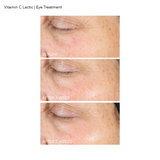 Firm & Bright Eye Treatment