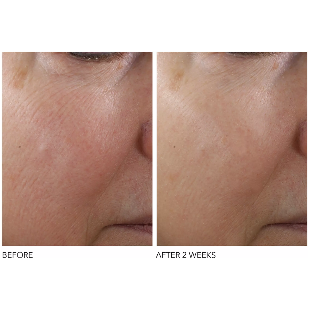 Advanced Retinol + Ferulic Texture Renewal Serum