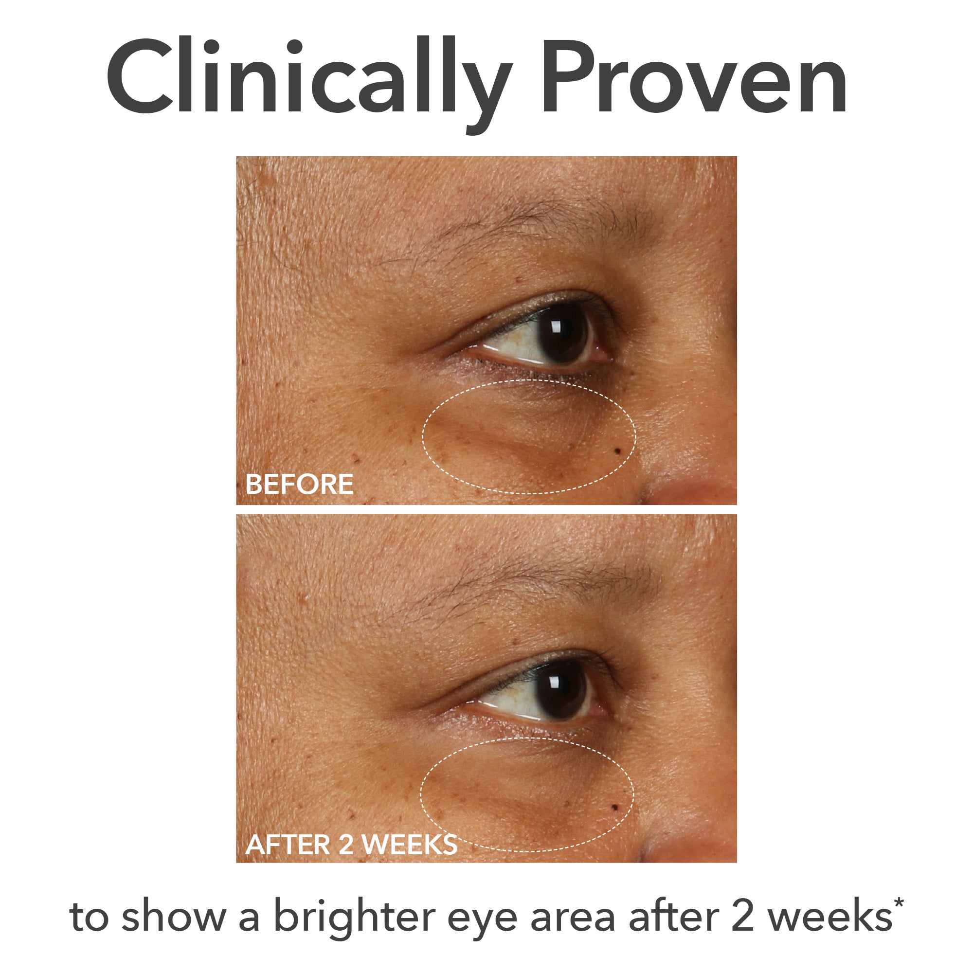 Fill + Repair eye cream 15ml